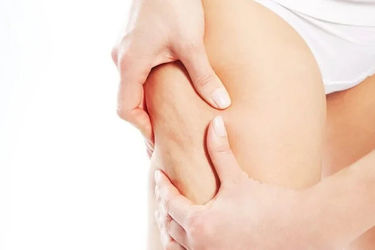 Come scegliere la crema anticellulite: guida all'acquisto