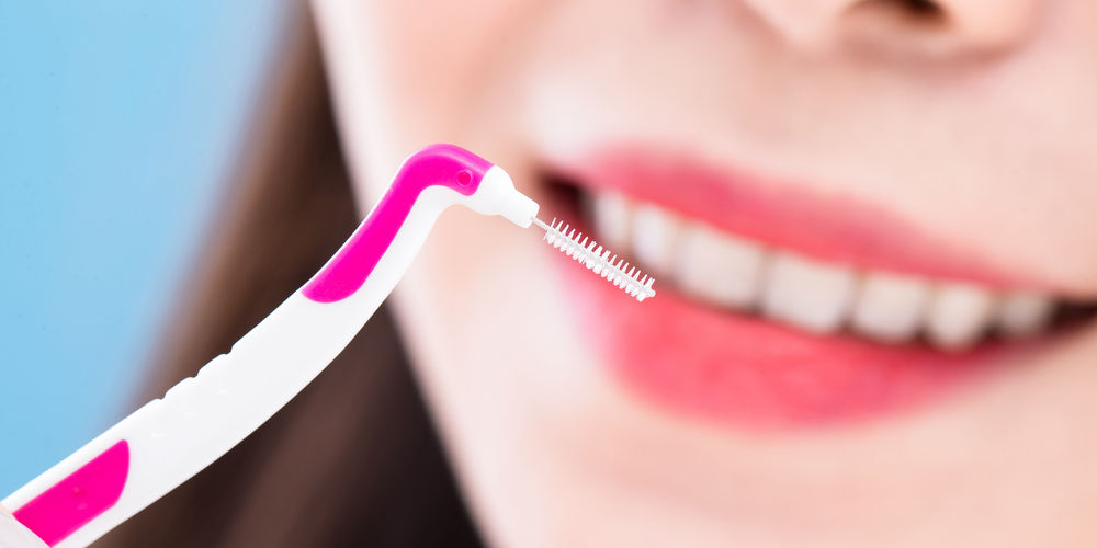 Come scegliere lo scovolino denti: guida all'acquisto