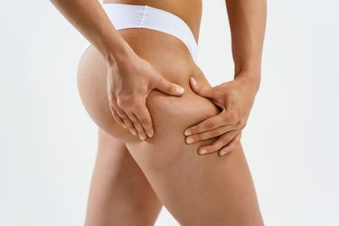 Come scegliere la crema anticellulite: guida all'acquisto