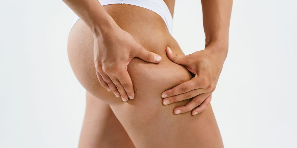 Come scegliere la crema anticellulite: guida all'acquisto